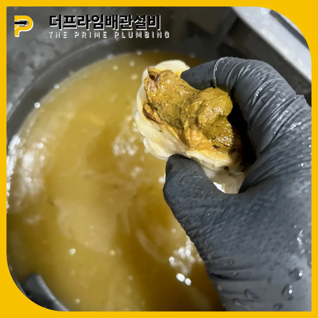 대변막혔을때