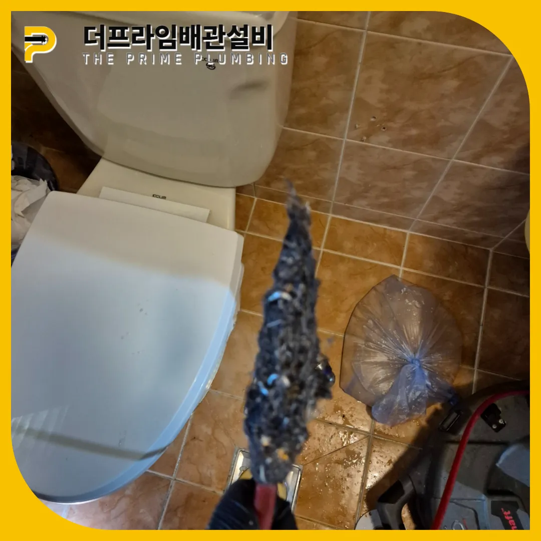 머리카락제거