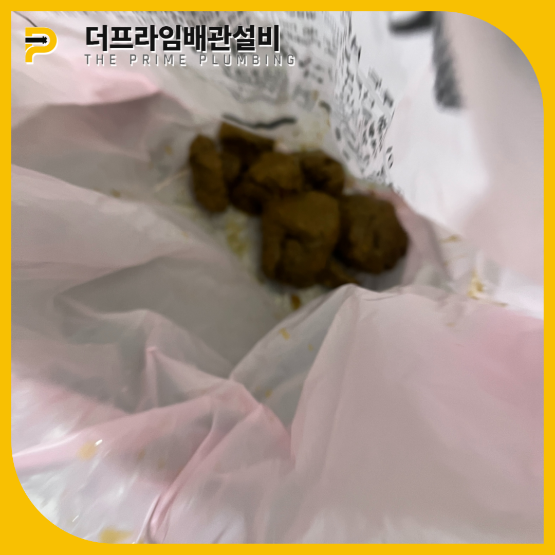 대변막힘해결