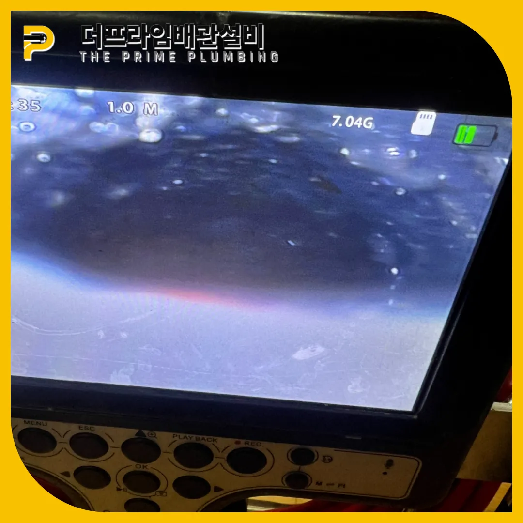 안산횡주관막힘