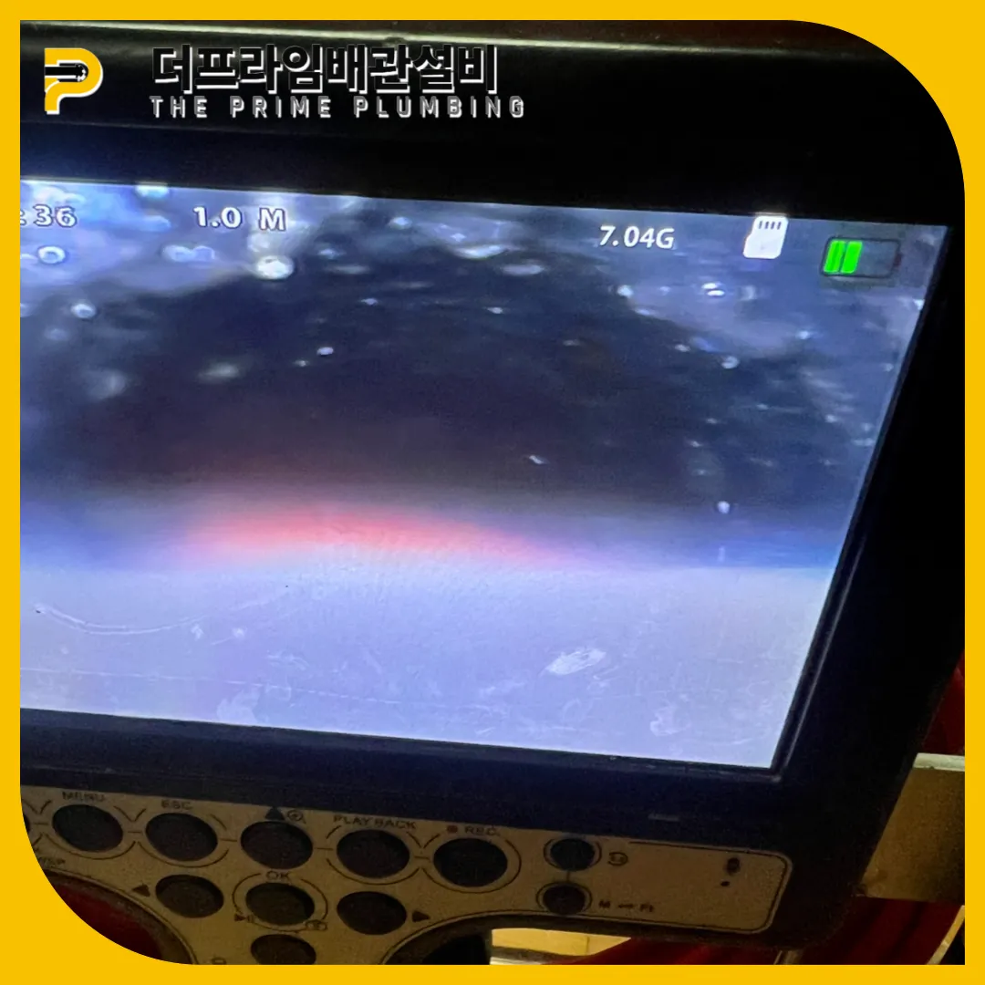 횡주관막힘원인