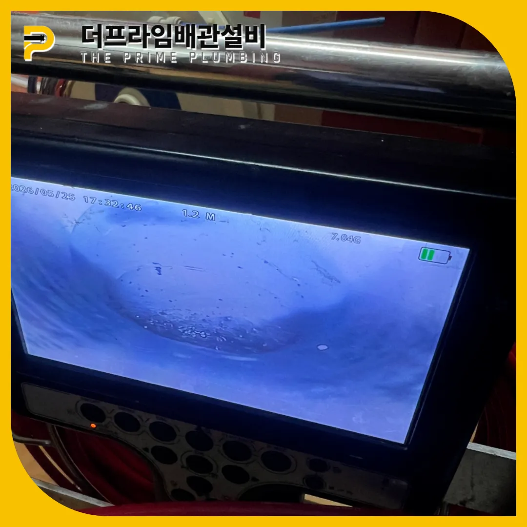 안산횡주관막힘