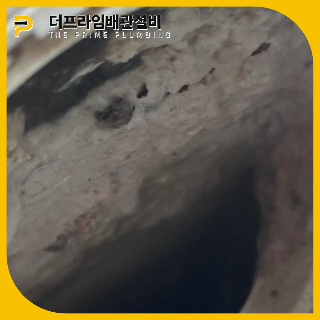횡주관막힘원인