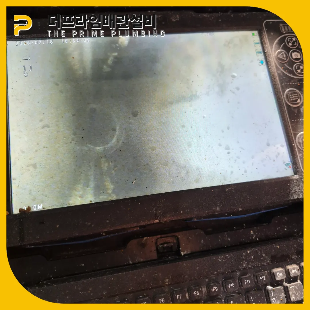 하남횡주관막힘