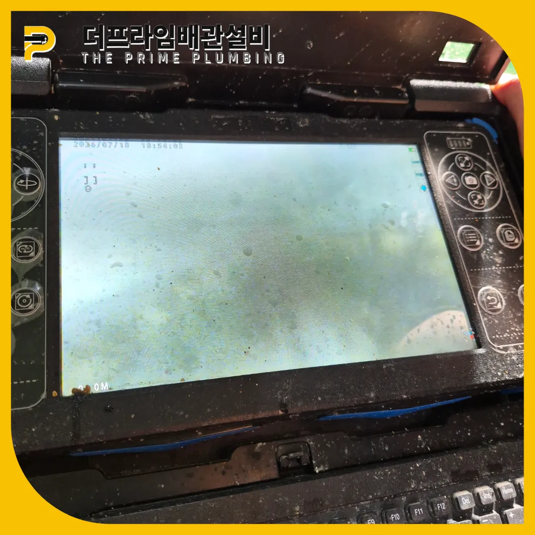 하남횡주관막힘