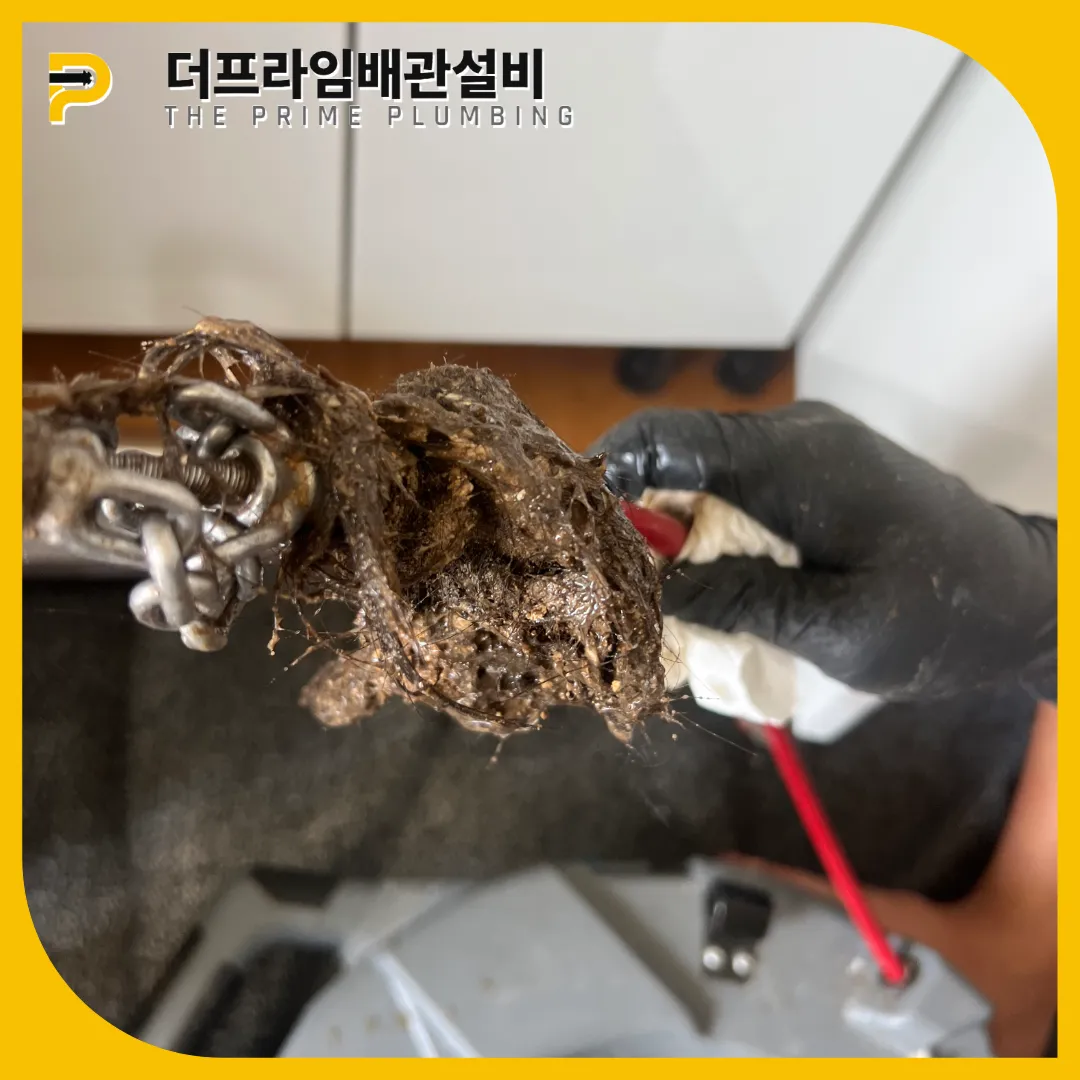 머리카락제거