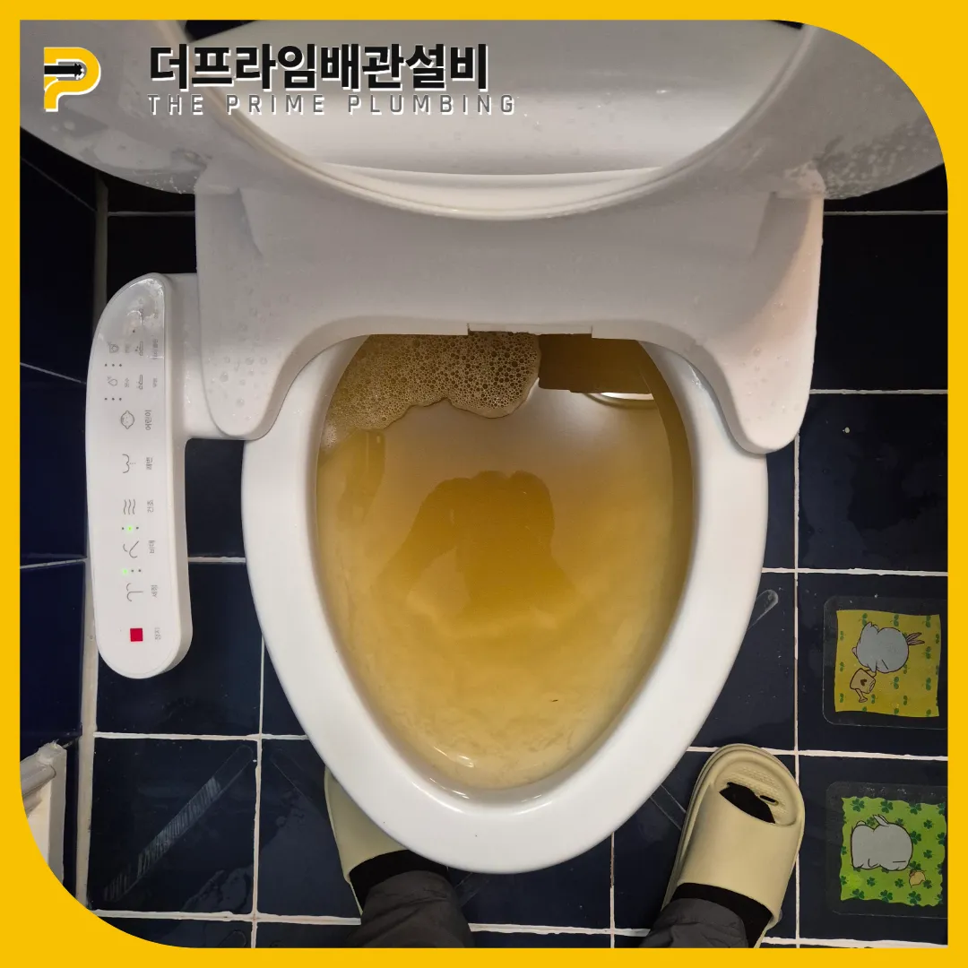 대변막힘
