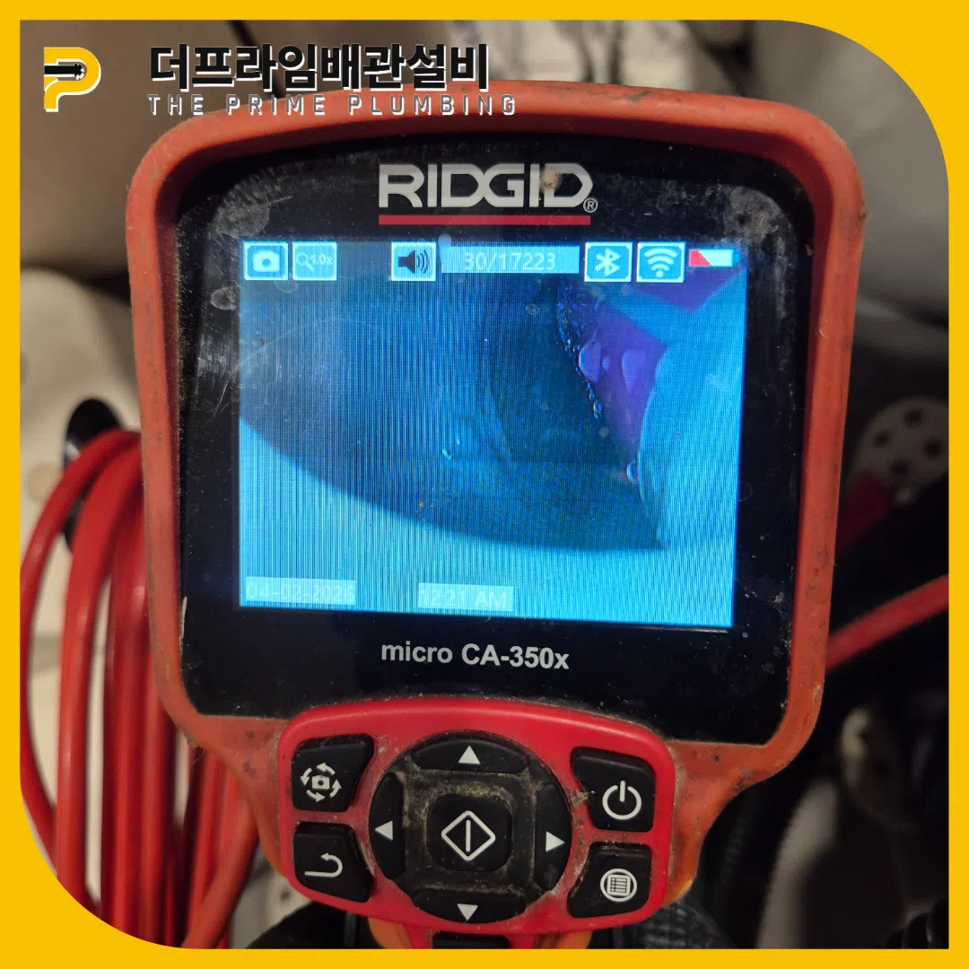 대변막힘
