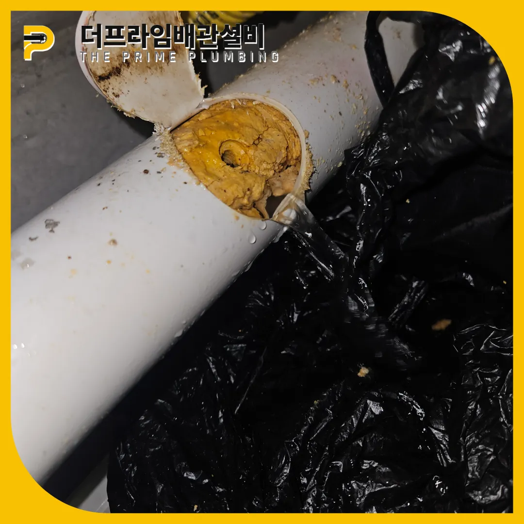 횡주관막힘
