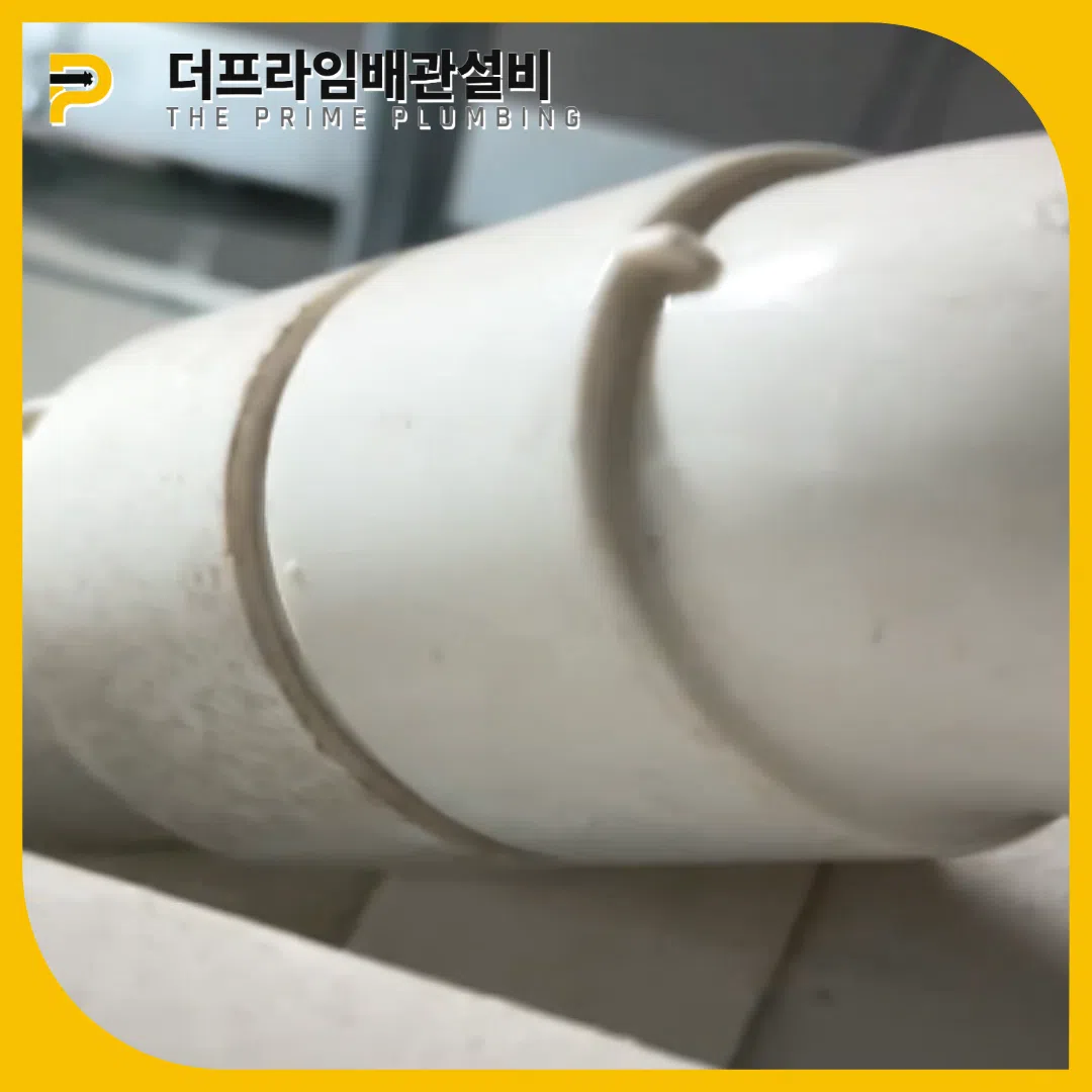 횡주관막힘