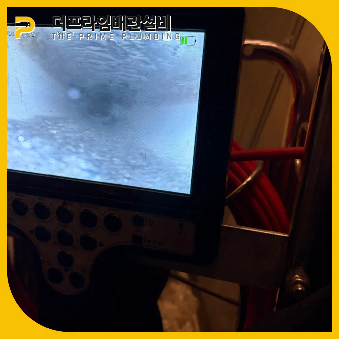 내시경진단
